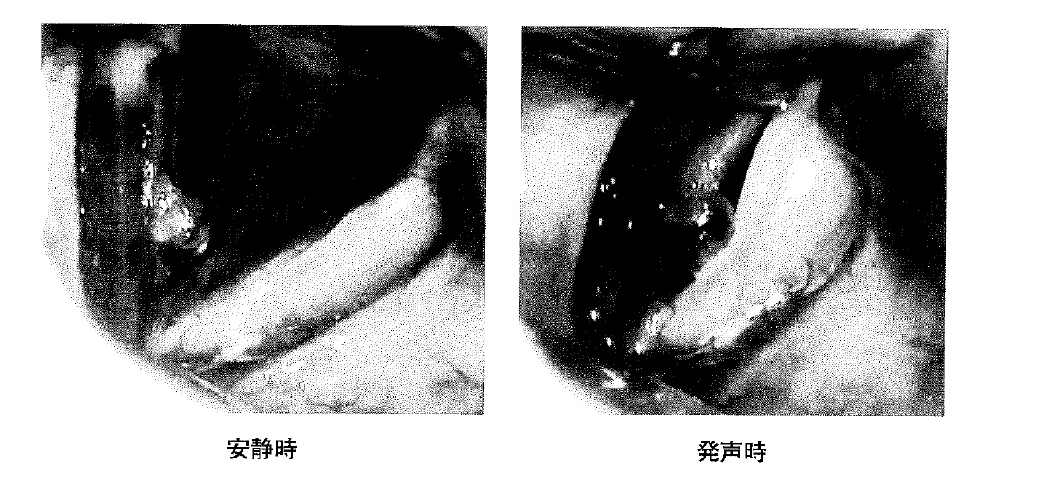 第24回第76問 図