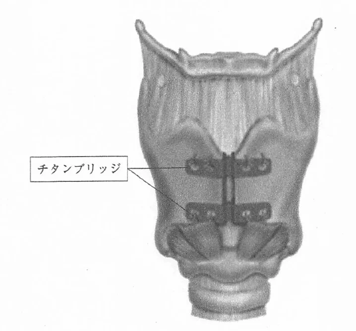 第28回第77問 図