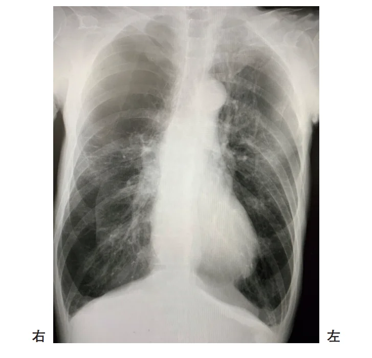 第57回午後第5問 図