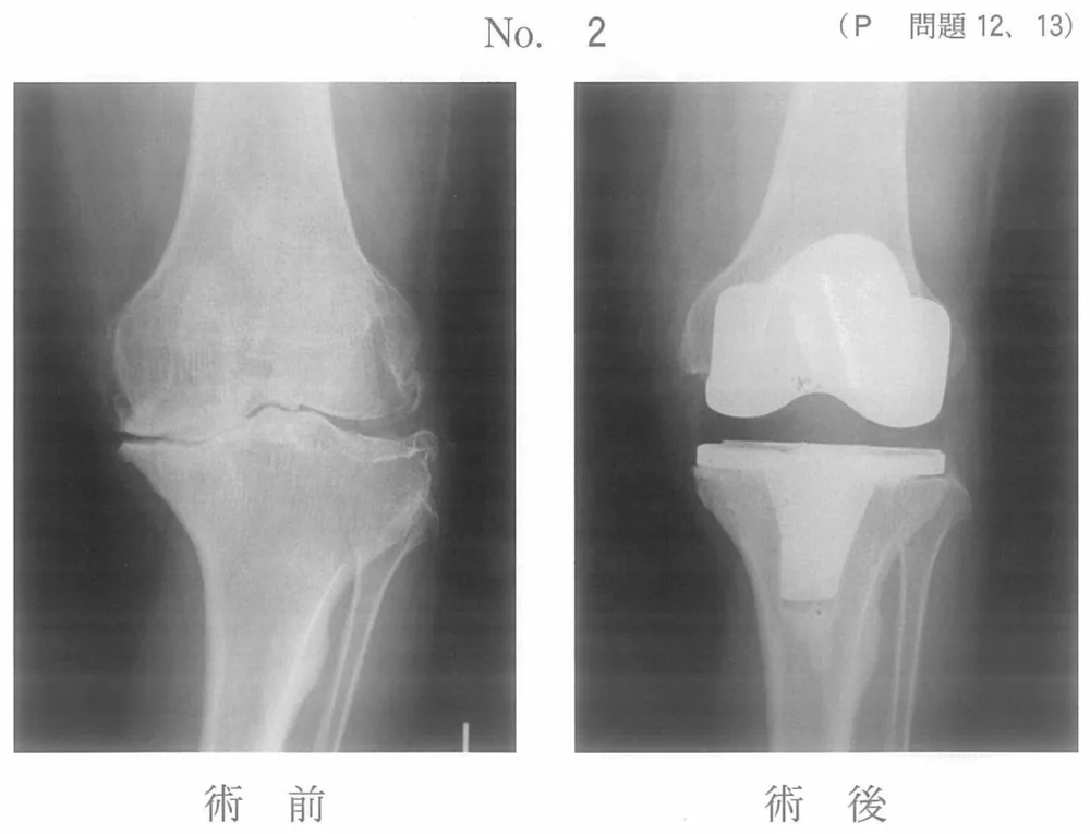 第44回午前第13問 図