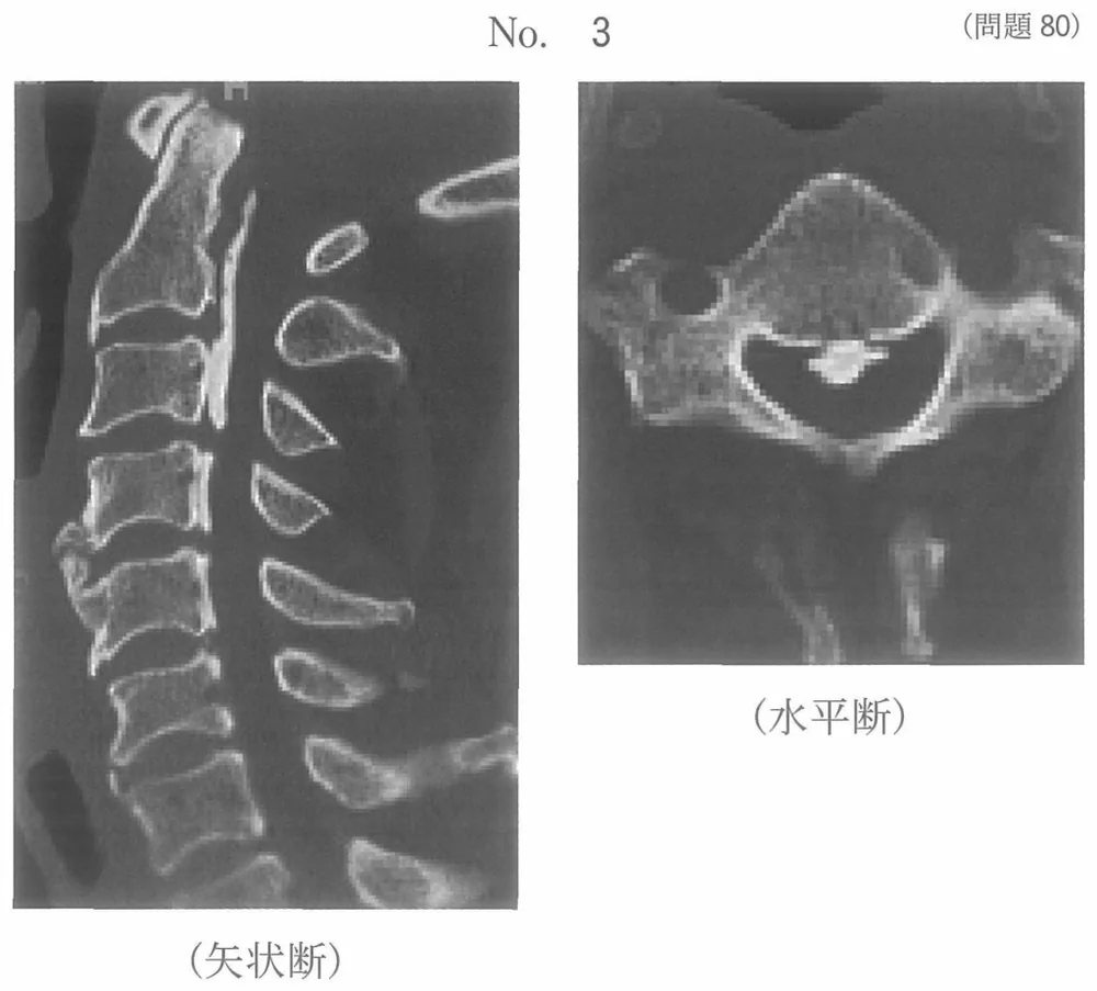 第44回午後第80問 図