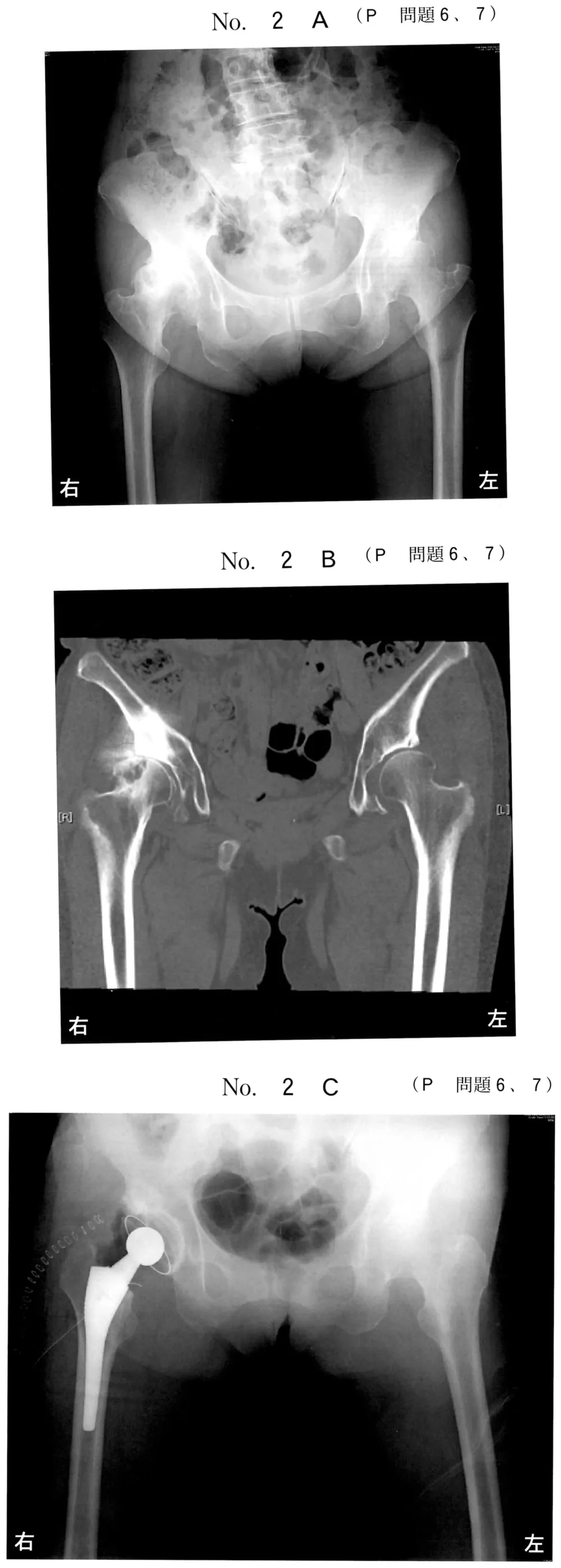 第45回午前第6問 図