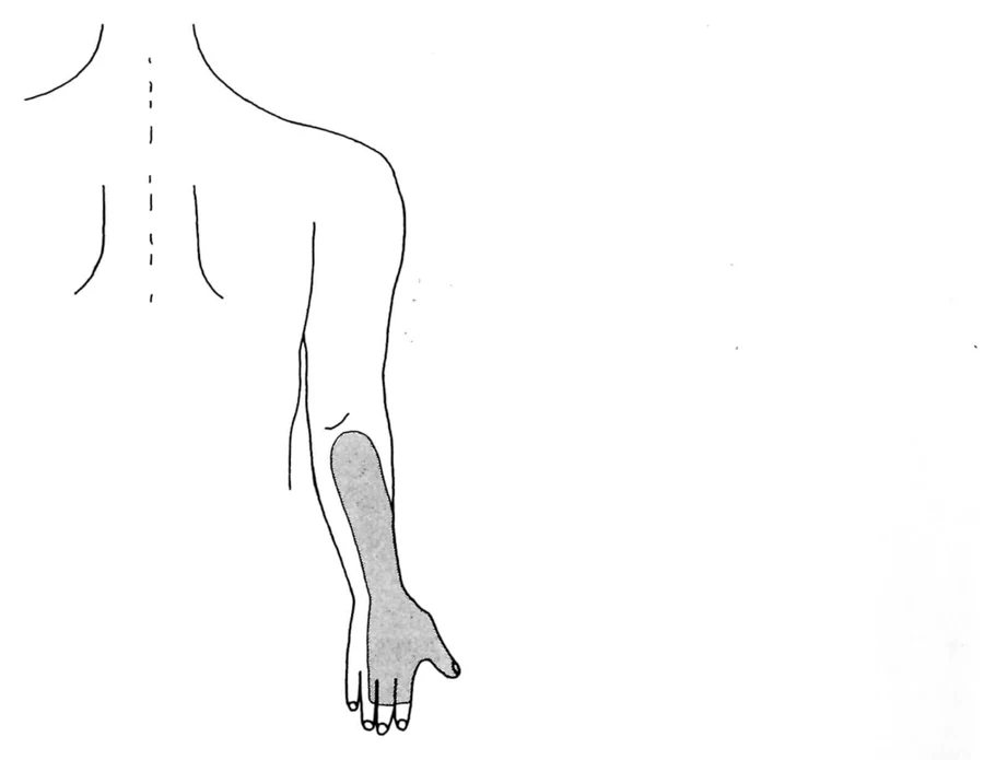 第45回午後第17問 図