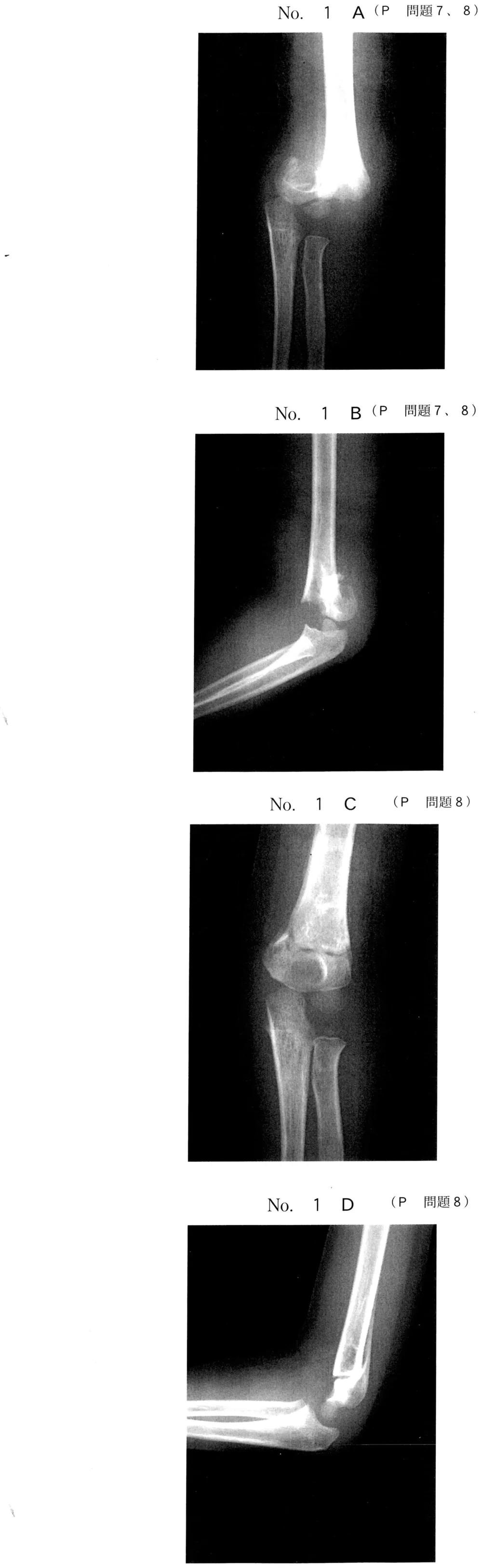 第46回午後第8問 図