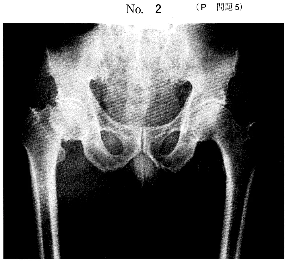 第47回午前第5問 図