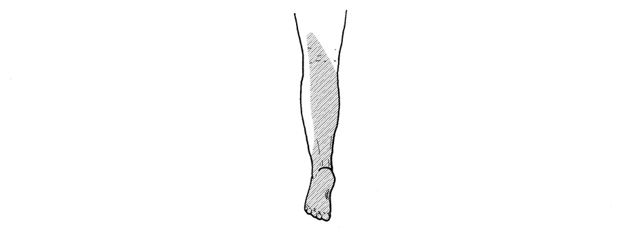 第47回午後第60問 図