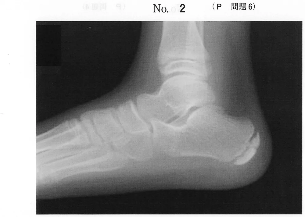 第48回午後第6問 図