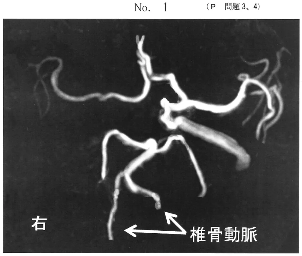 第49回午後第3問 図