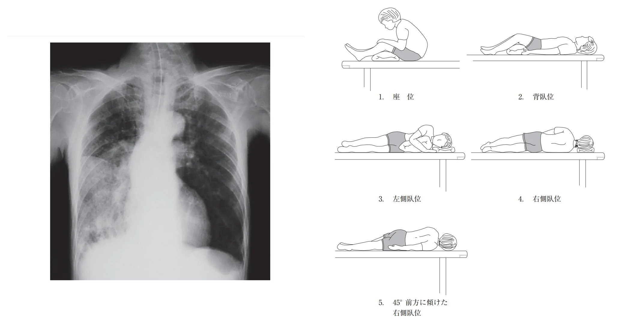 第50回午前第15問 図