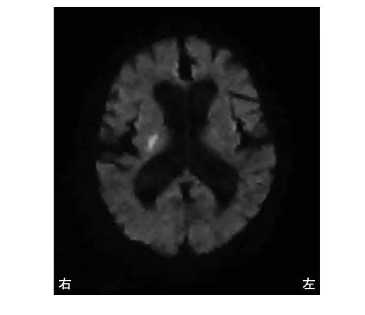 第51回午前第94問 図