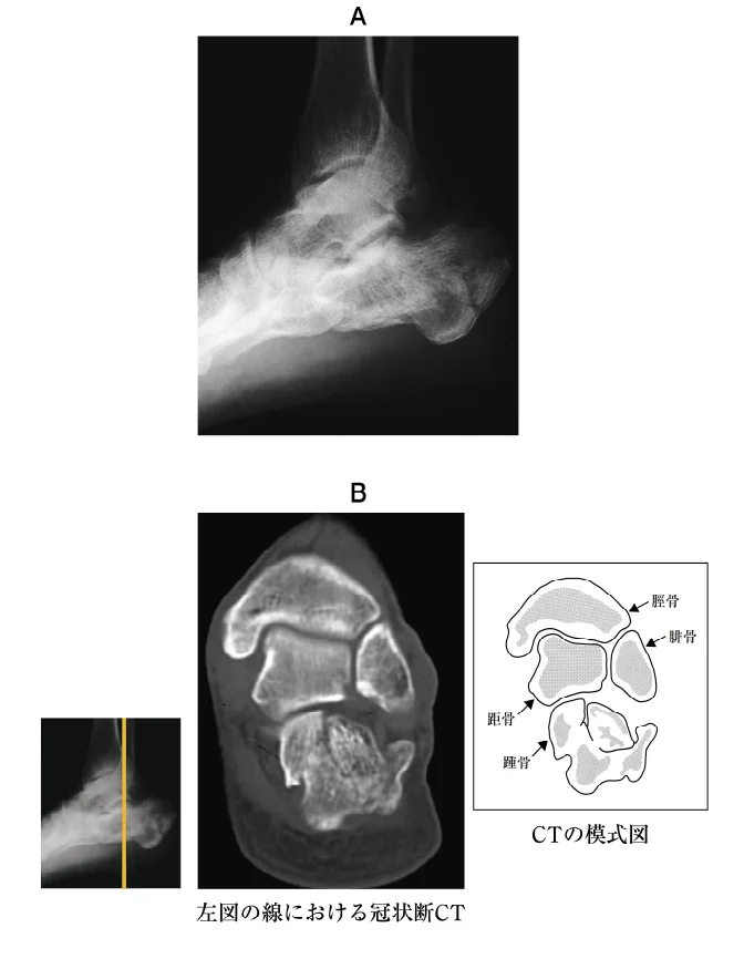 第53回午前第18問 図