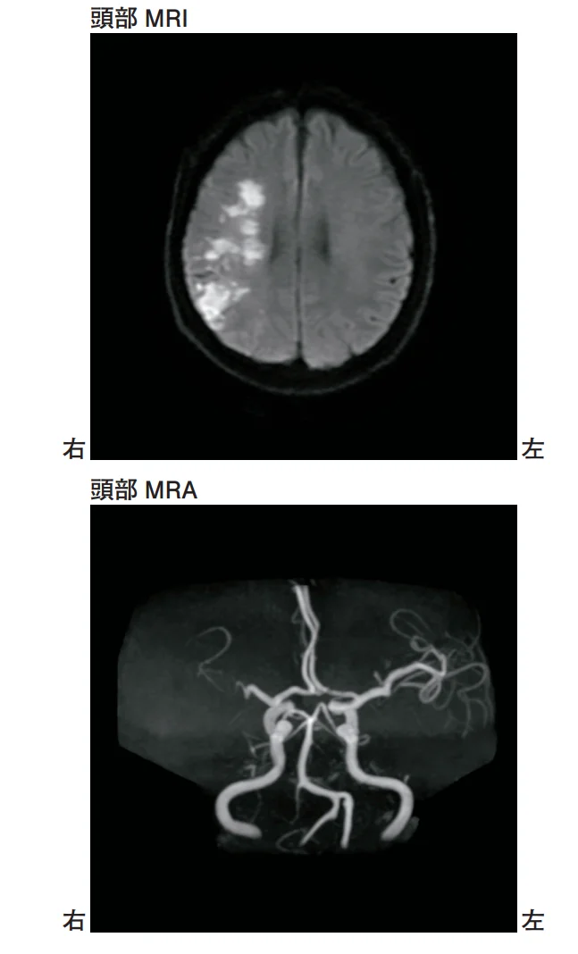 第54回午前第14問 図