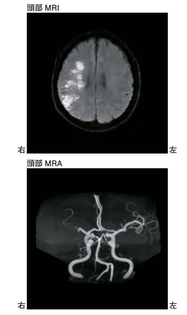 第54回午前第15問 図