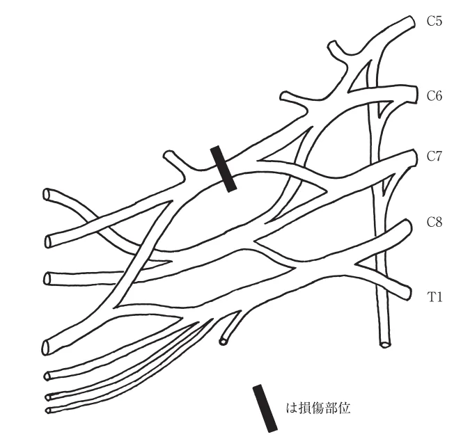 第54回午前第16問 図