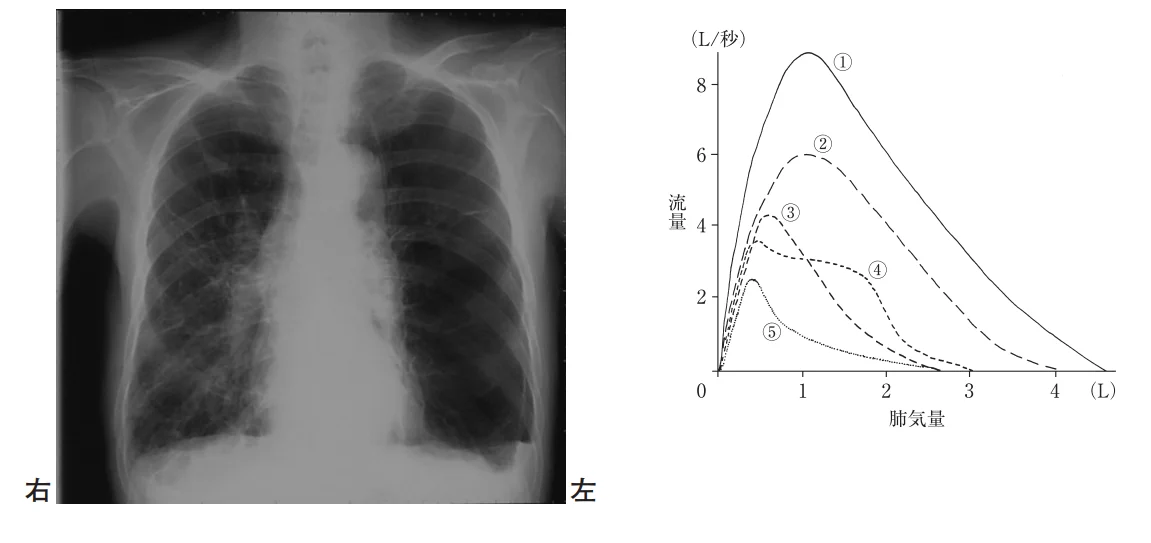 第55回午前第7問 図