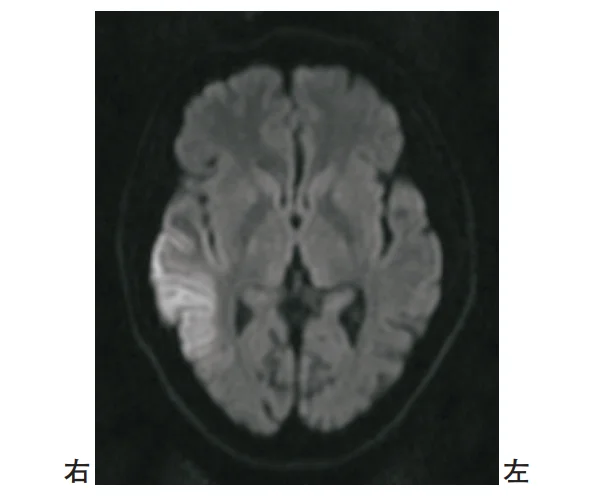 第56回午後第2問 図