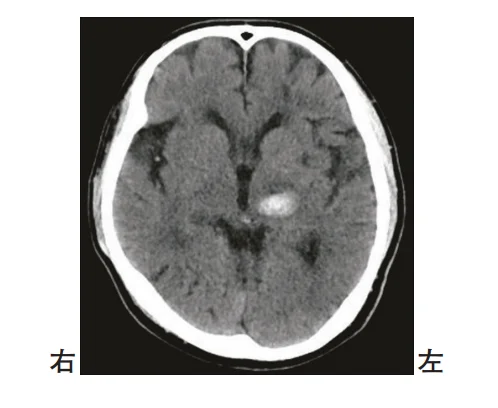 第56回午後第90問 図