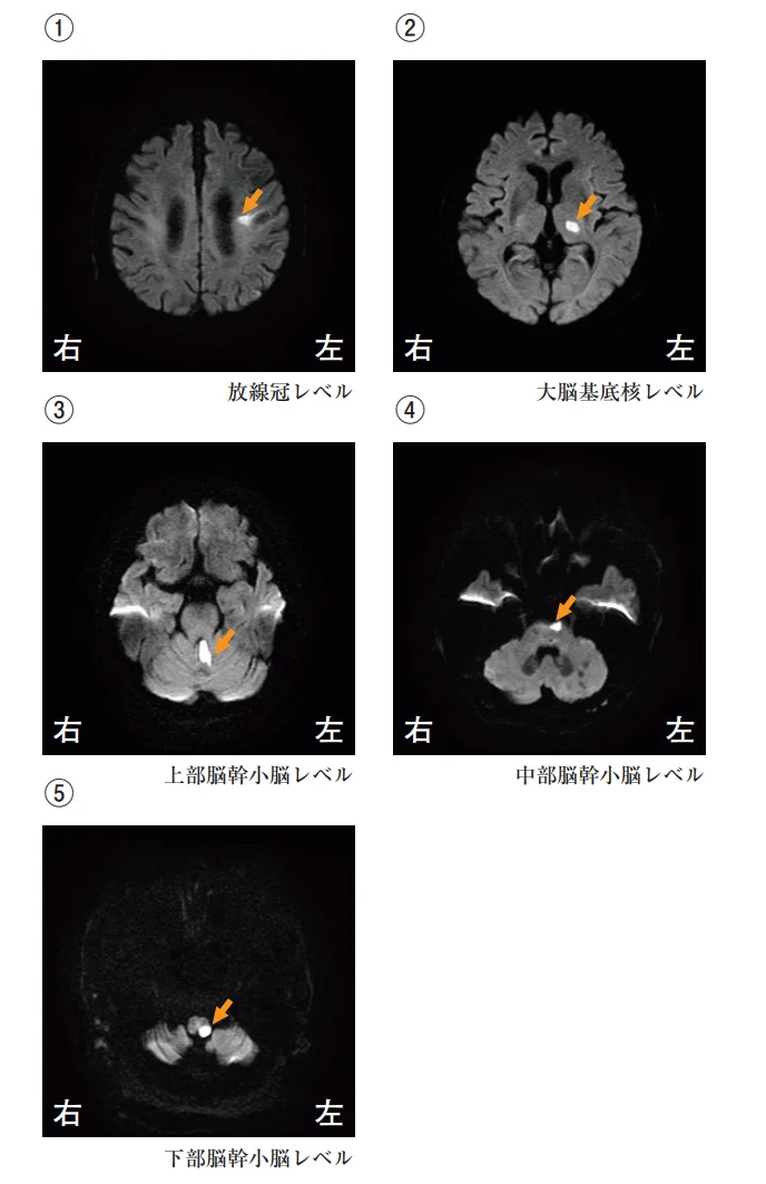 第57回午前第6問 図