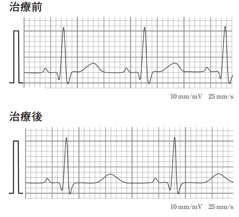 第57回午後第11問 図