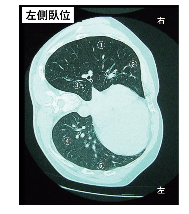 第57回午後第12問 図