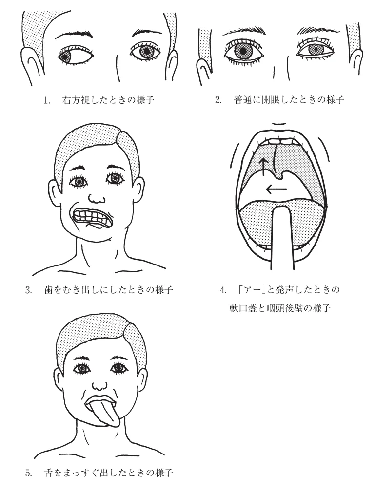 第58回午前第7問 図