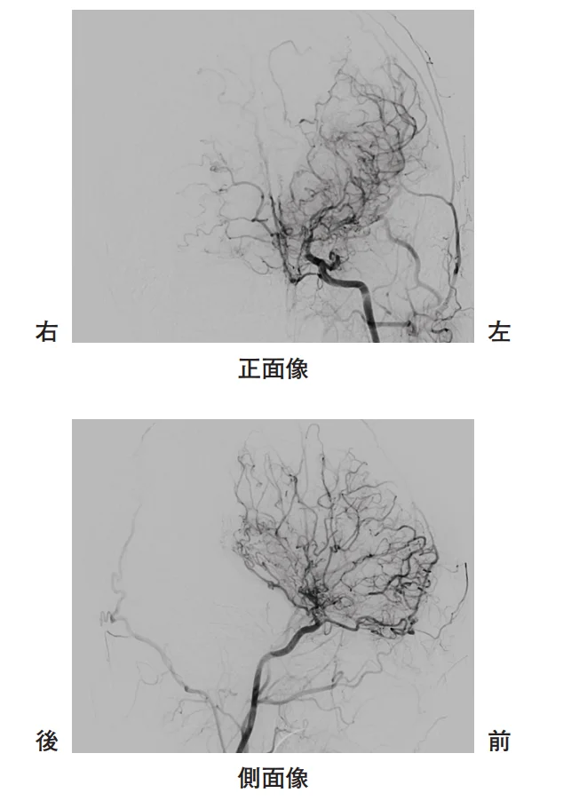第60回午後第15問 図