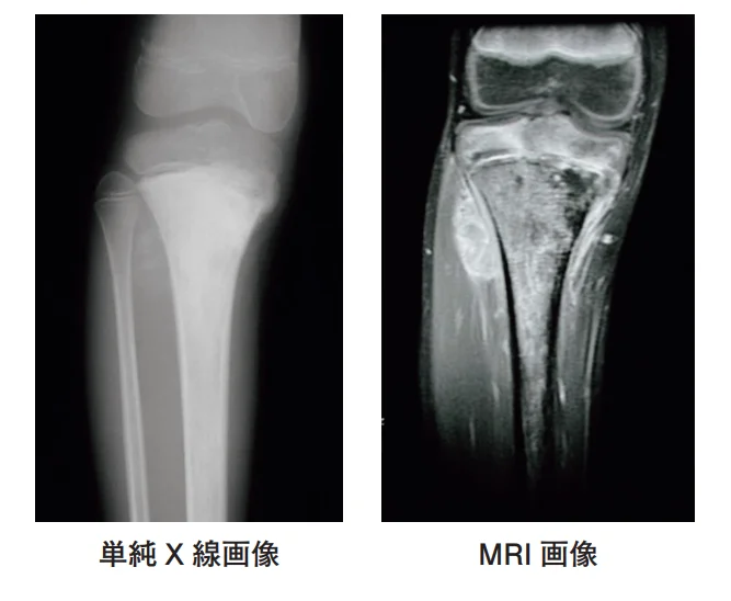 第61回午前第10問 図